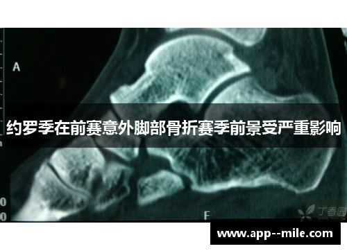 约罗季在前赛意外脚部骨折赛季前景受严重影响